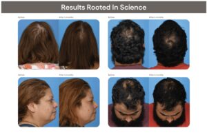 plated hair serum photos