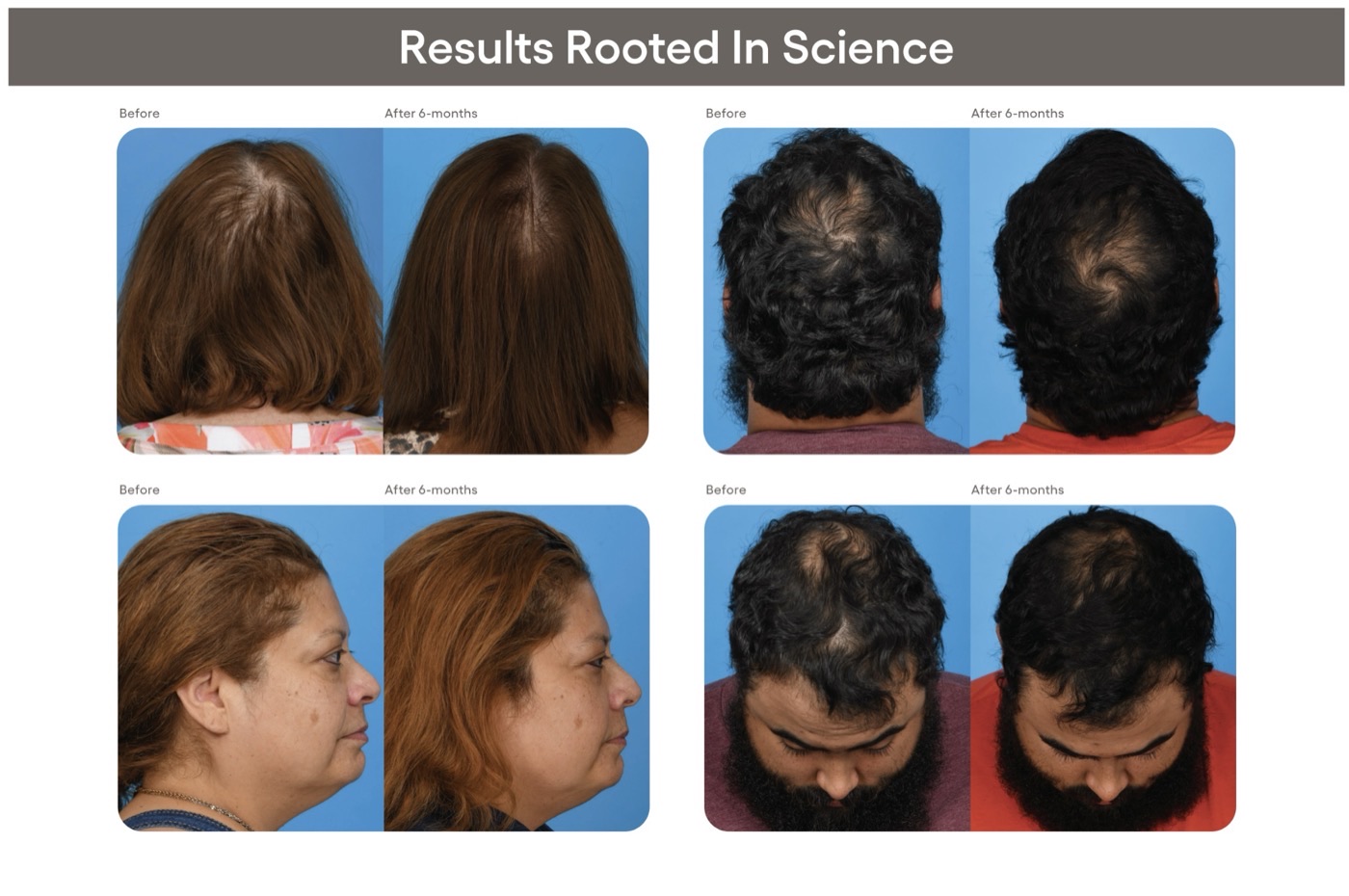 plated hair serum photos