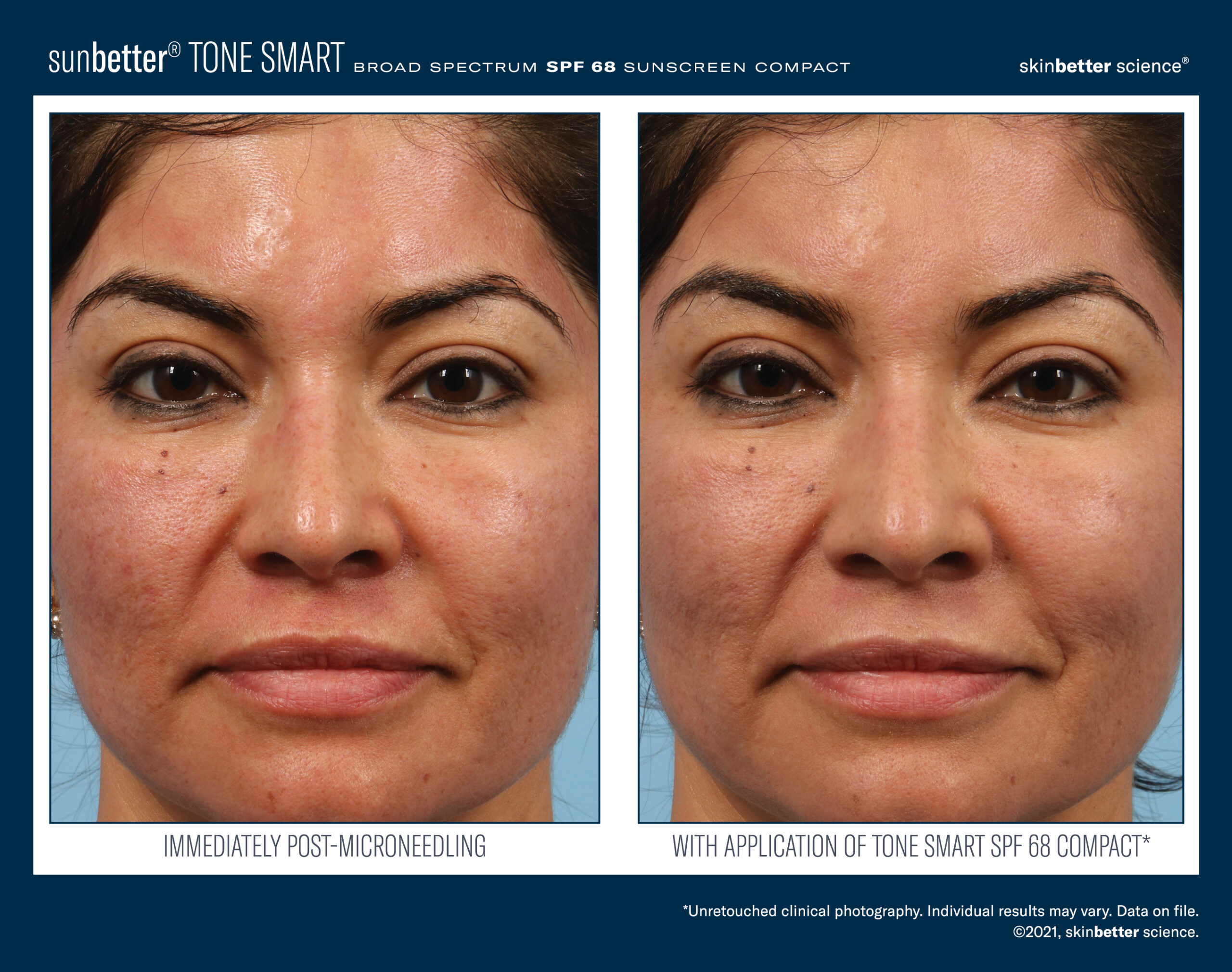 best makeup for microneedling