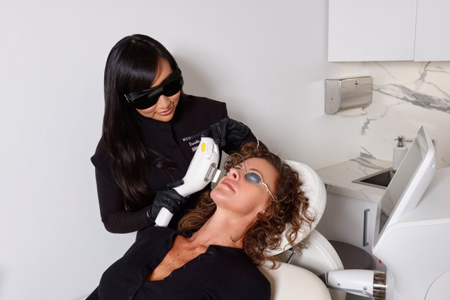 IPL Photofacial Treatment