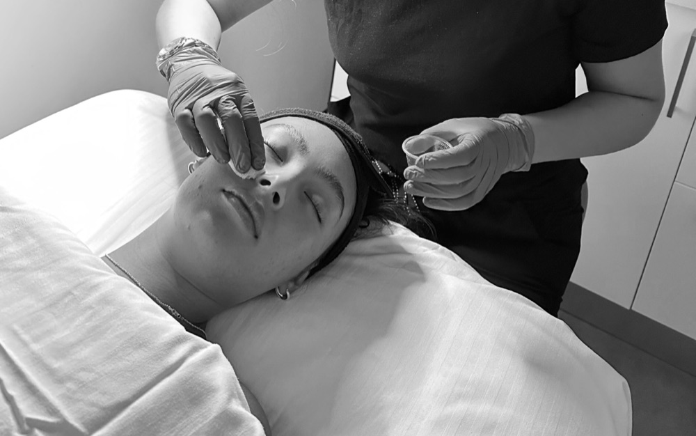 Aesthetician in gloves applying a clarifying solution to a client's face with a cotton pad during an acne facial