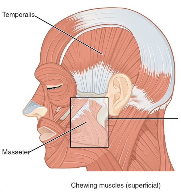 Anatomy illustration of the side of the head showing the chewing muscles, with the temporalis above the ear and the masseter along the back of the jaw